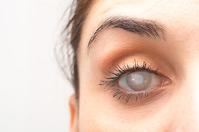 Contact Lens Fittings and Training